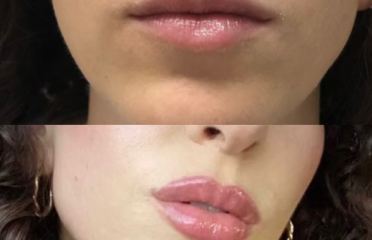 Aesthetic Skin Studio of Clearwater, LLC