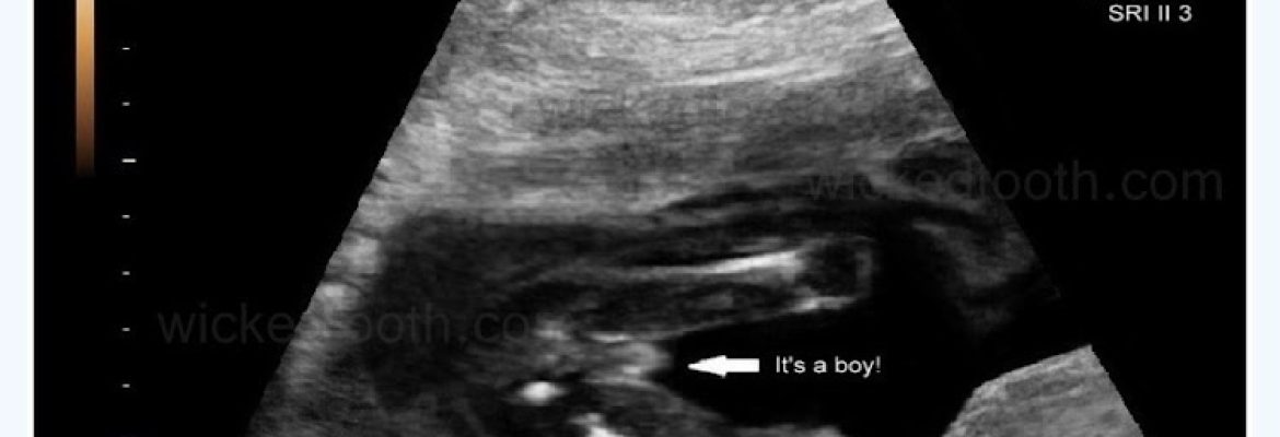 Bouncing Baby Ultrasounds
