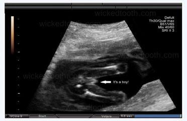 Bouncing Baby Ultrasounds